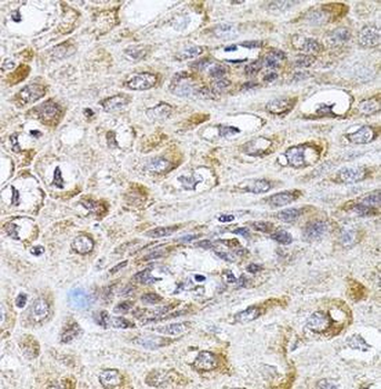 CETP Antibody