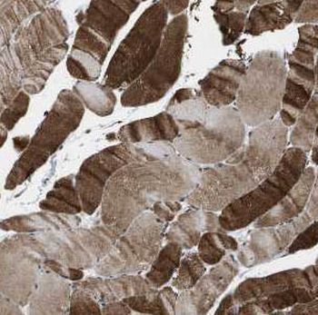CFLAR Antibody