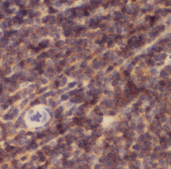 CFP Antibody