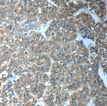 CFTR Antibody