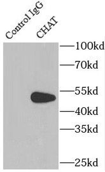 CHAT Antibody