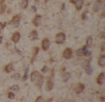 CHAT Antibody
