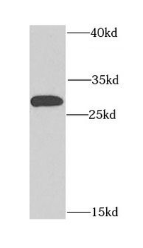 CHCHD3 Antibody