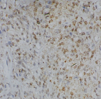 CHCHD6 Antibody