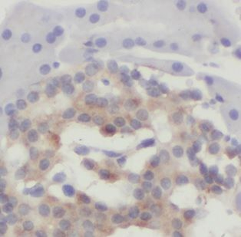 CHCHD7 Antibody