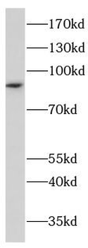 CHD2 Antibody