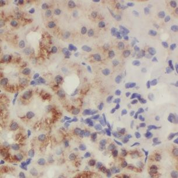 CHD3 Antibody