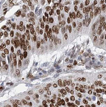 CHD4 Antibody