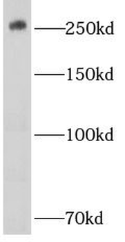 CHD4 Mouse Monoclonal Antibody