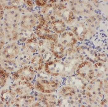 CHD9 Antibody
