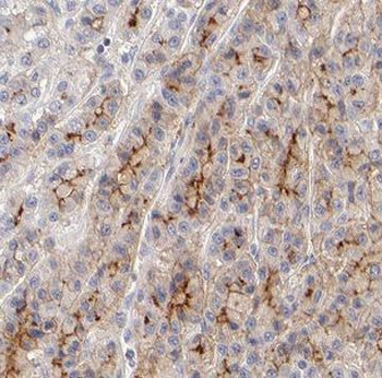CHDH Antibody