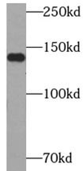 CHERP Antibody