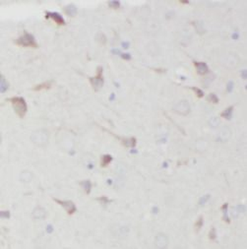 CHERP Antibody