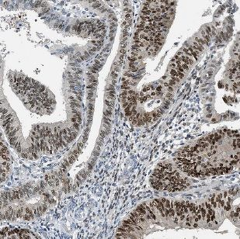 CHFR Antibody