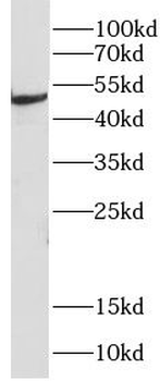 CHIT1 Rabbit Polyclonal Antibody