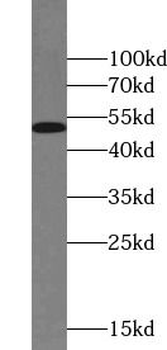 CHEK1 Mouse Monoclonal Antibody