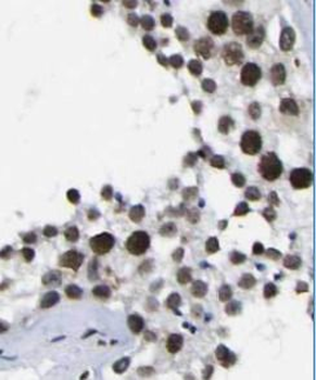 CHEK1 Mouse Monoclonal Antibody