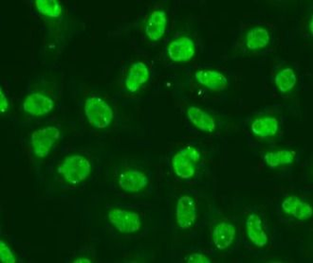 CHEK2 Rabbit Polyclonal Antibody
