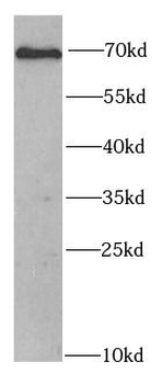 CHEK2 Rabbit Polyclonal Antibody