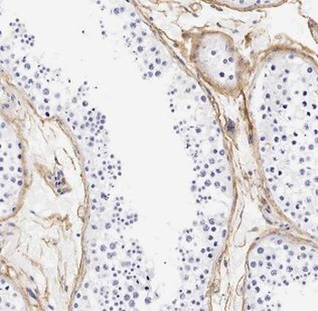 CHEK2 Rabbit Polyclonal Antibody