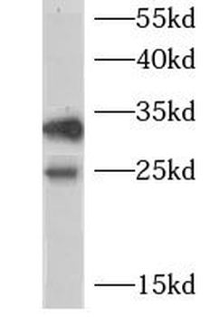 CHMP1A Antibody