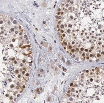 CHMP1A Antibody