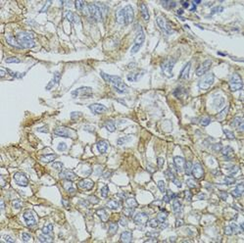 CHMP4B Antibody