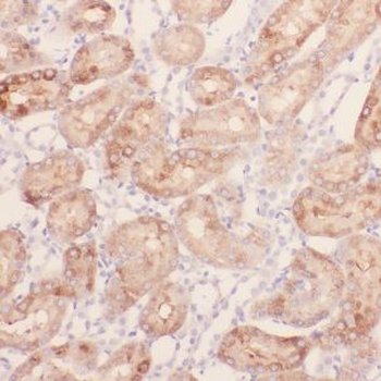 CHMP7 Antibody