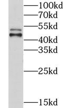 CHKA Antibody