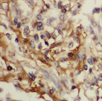 CHKA Antibody