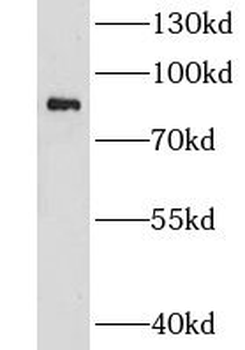 CHPF Rabbit Polyclonal Antibody