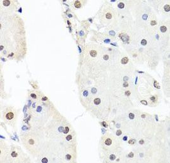 CHRAC1 Antibody