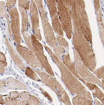CHRNA1 Antibody