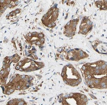 CHRNA3 Antibody