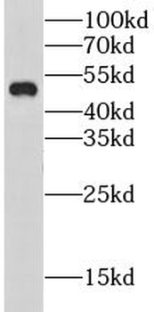 CHRNA5 Rabbit Polyclonal Antibody