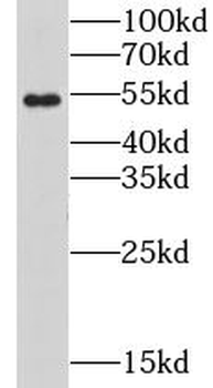 CHRNB1 Antibody
