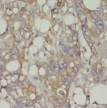 CHRNB1 Antibody