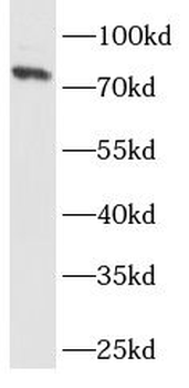 CHGA Rabbit Polyclonal Antibody