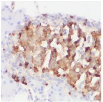 CHGA Rabbit Polyclonal Antibody