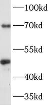 CHGA Rabbit Polyclonal Antibody