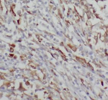 CHGA Rabbit Polyclonal Antibody