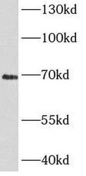 CHGA Mouse Monoclonal Antibody