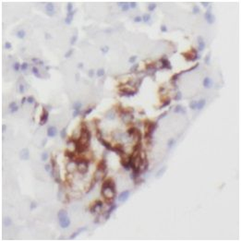 CHGA Mouse Monoclonal Antibody