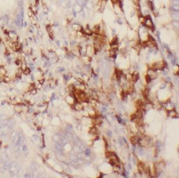 CHST12 Antibody