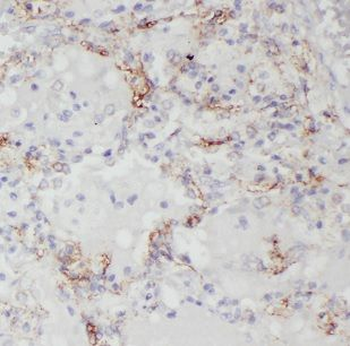 CHSY1 Antibody