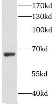 SLC5A7 Rabbit Polyclonal Antibody