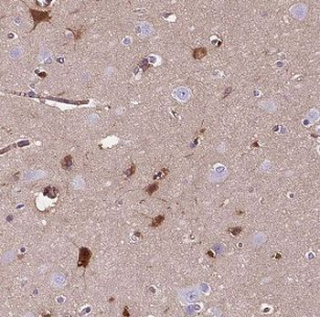 SLC5A7 Antibody