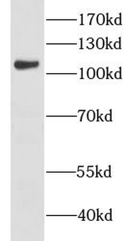 CHTF18 Rabbit Polyclonal Antibody