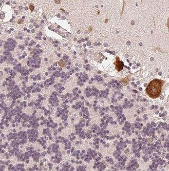 CHTF18 Antibody