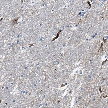 CHURC1 Antibody
